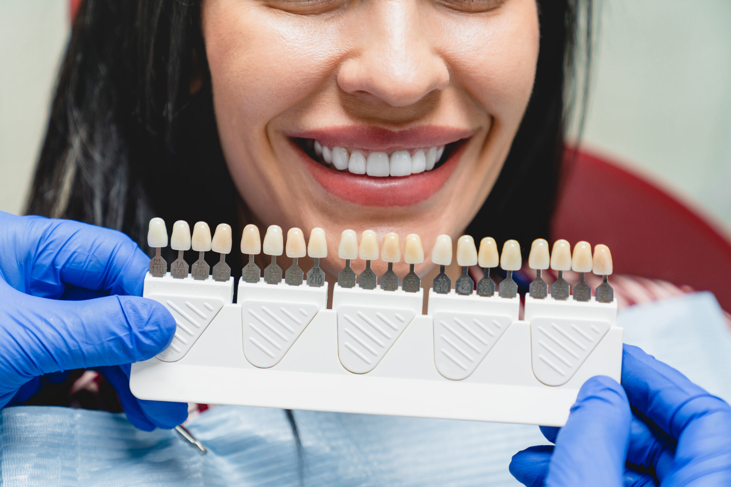 veneers teeth